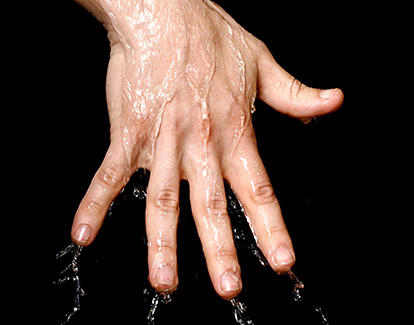 Hiperhidrosis localizada: palma de la mano con sudoración excesiva