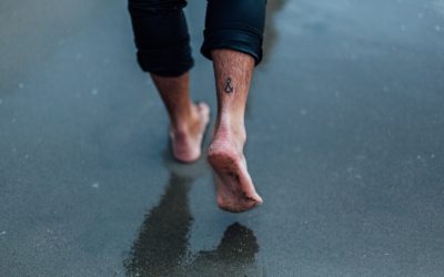 Hiperhidrosis plantar